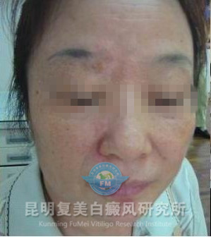 治疗中_副本.jpg